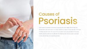 Causes of Psoriasis