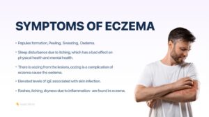 symptoms of eczema