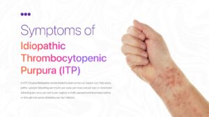 Symptoms of ITP