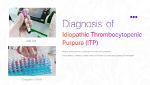 Diagnosis of ITP