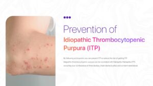 Prevention of ITP