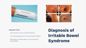 Diagnosis of IBS