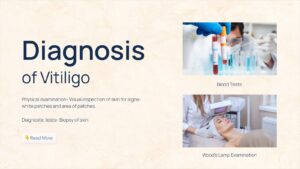 Diagnosis of vitiligo