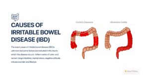 Causes of IBD