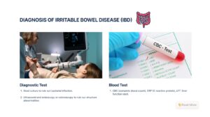 Diagnosis of IBD