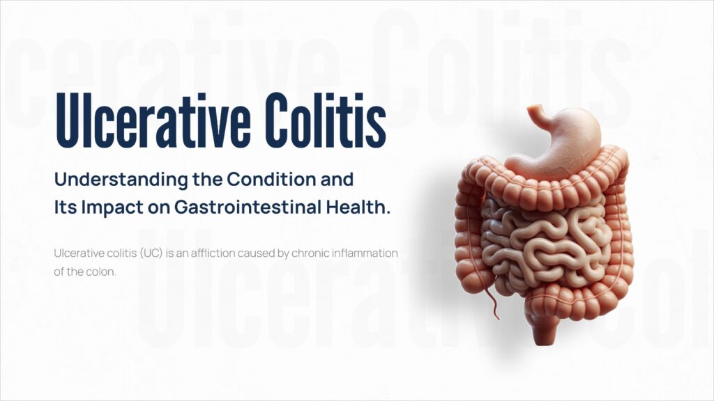 Ulcerative Colitis