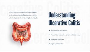 Understanding ulcerative colitis 